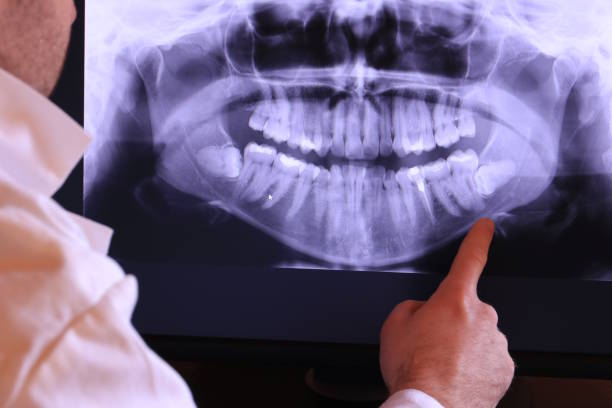 Best Dentist for Tooth Abscess  in Reno, NV